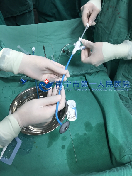 我院胸心血管外科区内率先开展经颈内静脉超声下封堵房间隔缺损