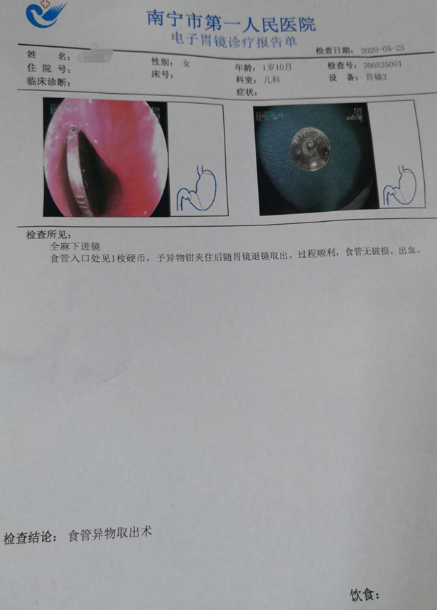 警惕！危险的金属“奥利奥”