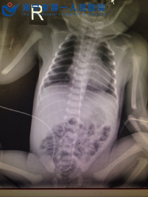 打开生命的救护通道