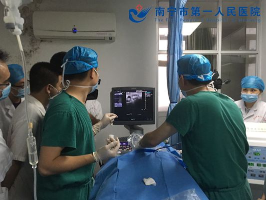 微波消融 开启甲状腺结节微创治疗新时代