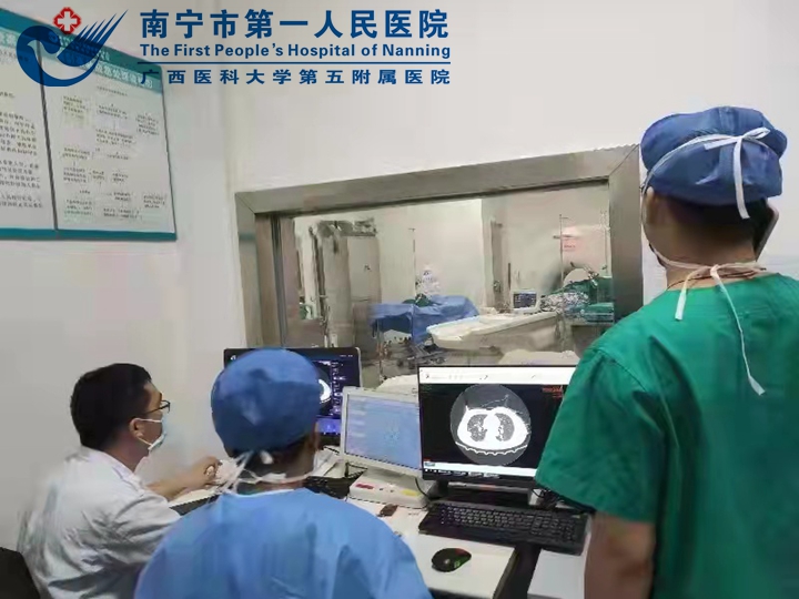 原发肝癌肺转移，微波消融解难题 ——市一青秀分院成功开展首例CT引导下的肺部肿瘤微波消融术