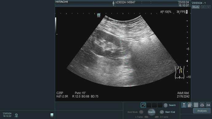 肾内科特色诊疗技术