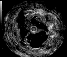 消化内科一区特色诊疗技术