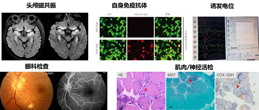 神经免疫与感染性疾病