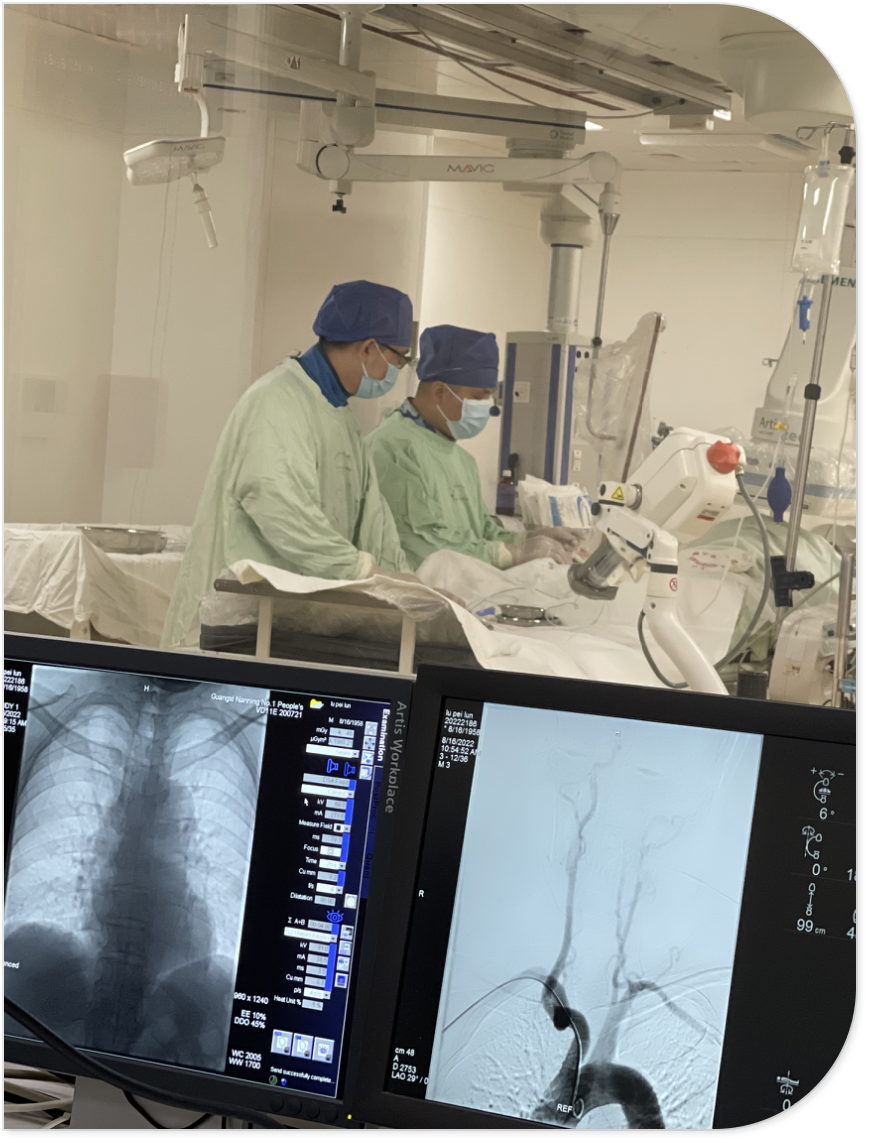 神经血管介入技术