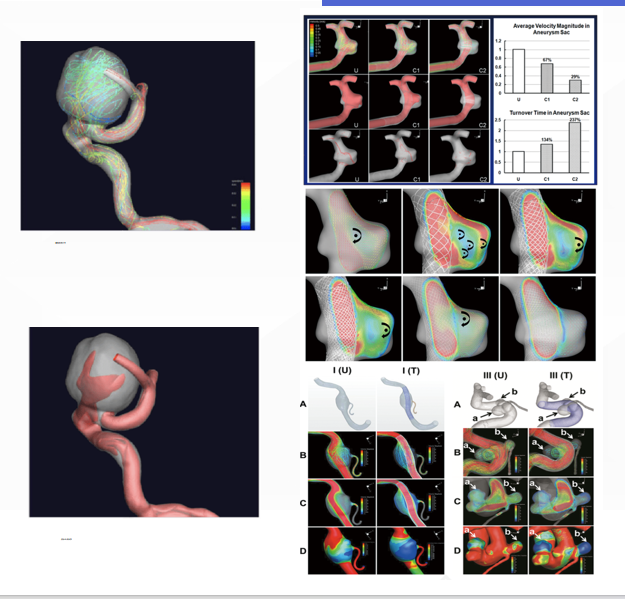 颅内动脉瘤一站式分析技术